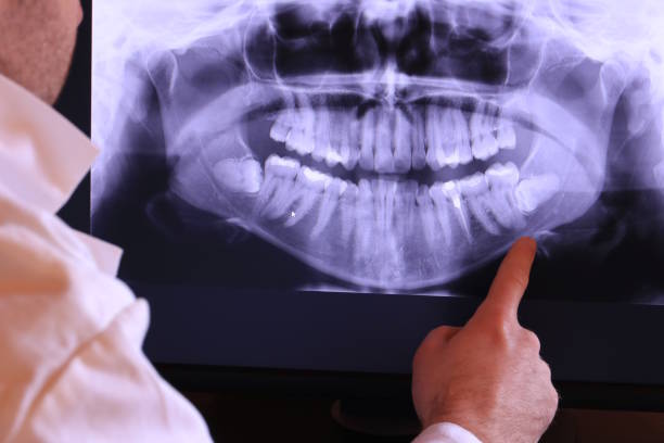 Best Emergency TMJ Treatment in Almont, MI