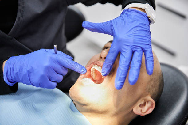 Best Emergency Wisdom Teeth Removal in Almont, MI